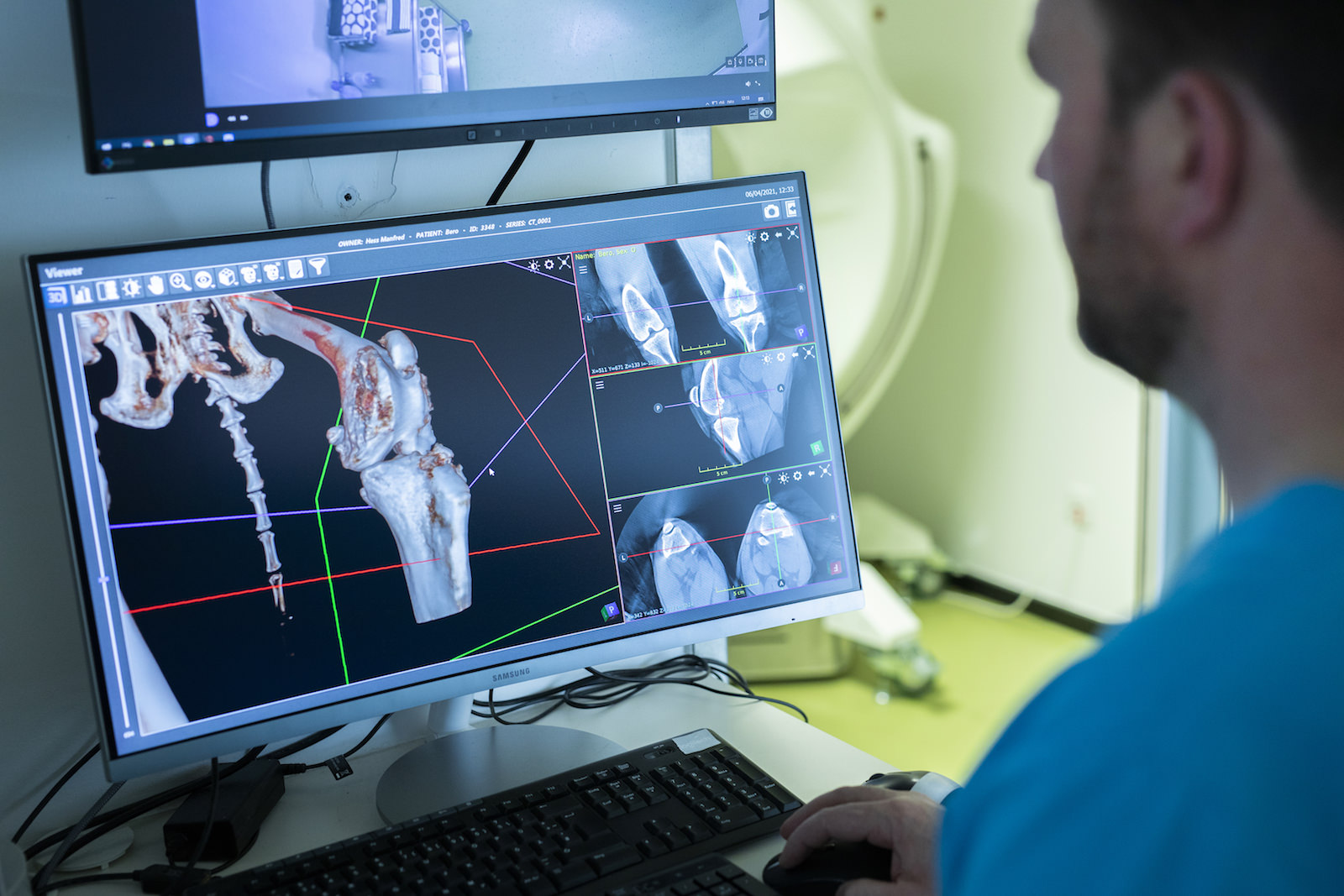 Dr. Seewald betrachtet CT-Scan Aufnahmen auf Computerbildschirm